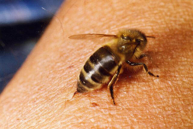 abeja-picando.jpg